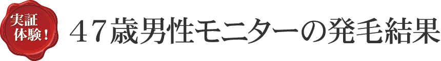 実証実験！47際男性モニターの発毛結果